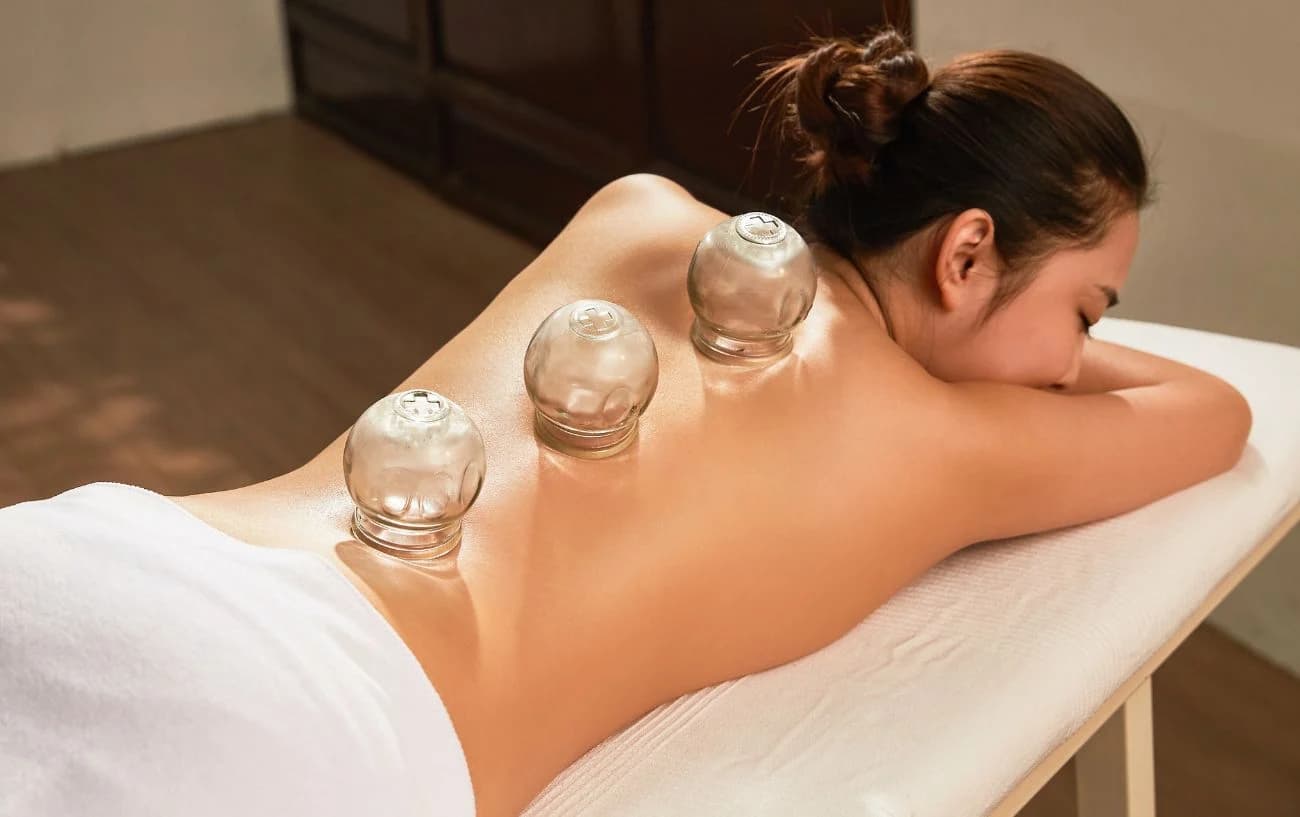 Cupping Therapy